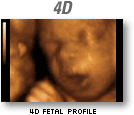 Image of 4D Fetal Profile