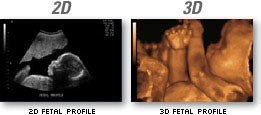 Images of 2D and 3D Fetal Profiles